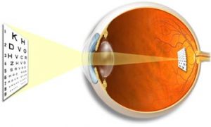 Emmetropic Vision