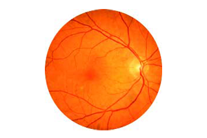 Diseases of the Eye thumbnail